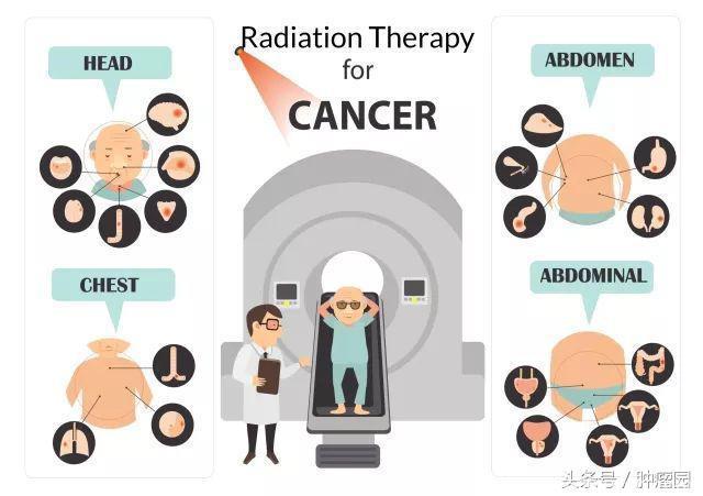 癌症≠绝症！被你当成“辅助疗法”的放疗，治愈了近两成癌症患者