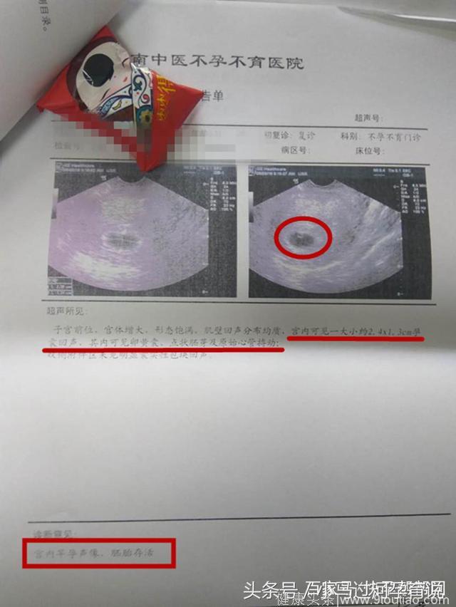 「接好孕」输卵管梗阻+盆腔粘连，在我准备放弃时却发现怀孕