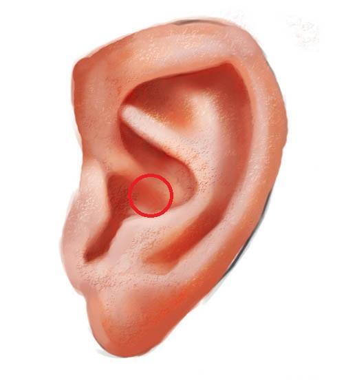 耳朵这样，是冠心病的重要征兆！
