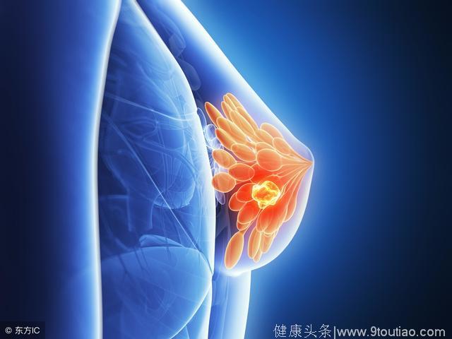 乳腺增生会变成“乳癌”吗？医生：这种情况可能会