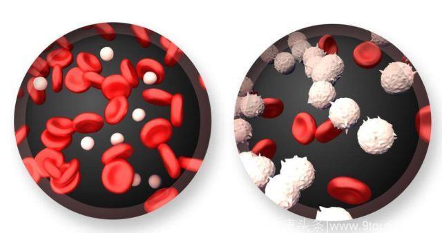 总看到电视剧里的“白血病”，是怎么回事？