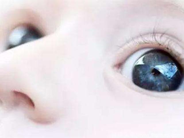 宝宝眼睛有秘密，出现这5种“怪眼”家长一定要警惕！