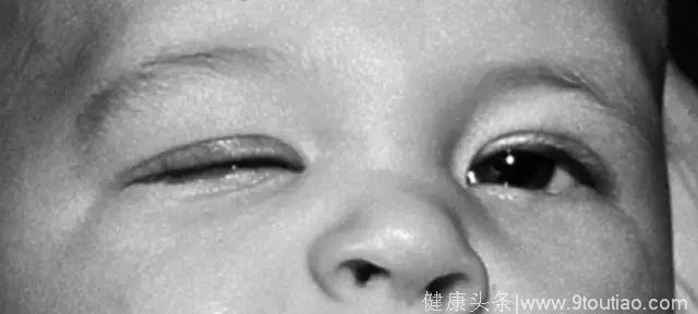 宝宝眼睛有秘密，出现这5种“怪眼”家长一定要警惕！