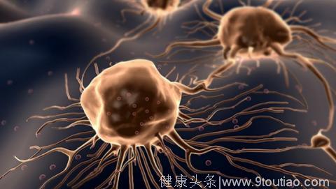 国家癌症中心：中国恶性肿瘤5年生存率提升到40.5%