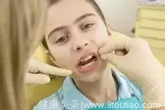 孩子几岁才能开始用牙线？葉子口腔科普