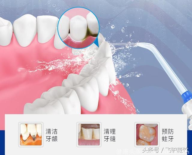 怎么清理口腔卫生，才是正确的姿势？