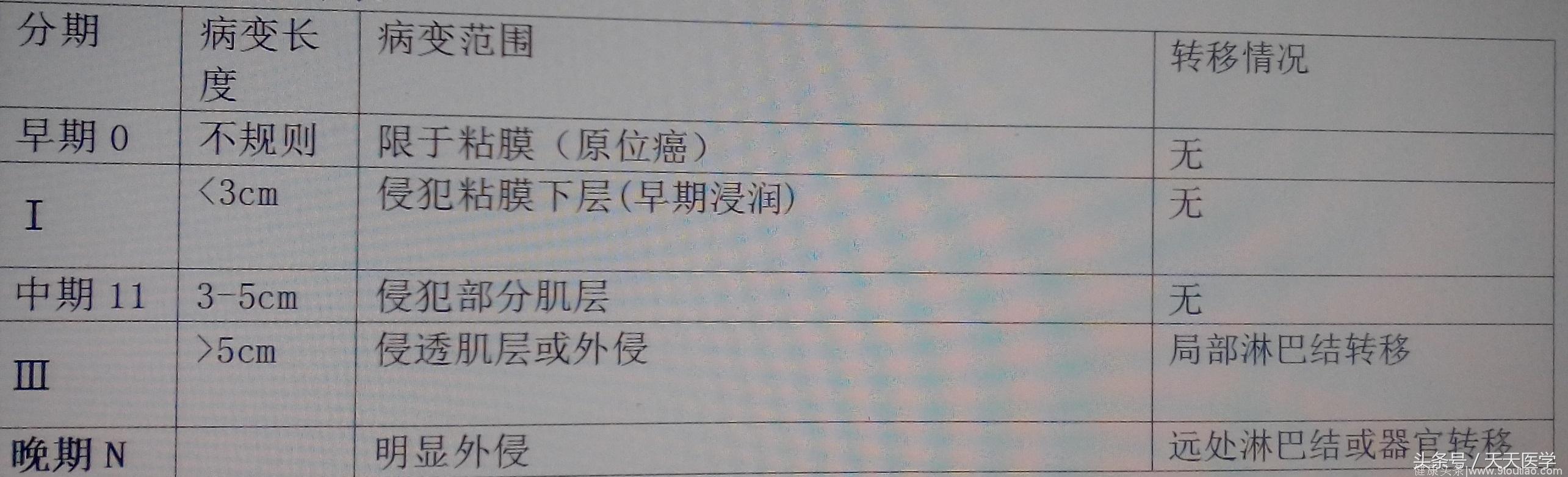 食管癌的病因、诊断、治疗常识，来了解一下