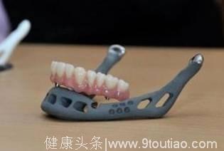 从研发到应用 佛企抢占3D打印医用新风口