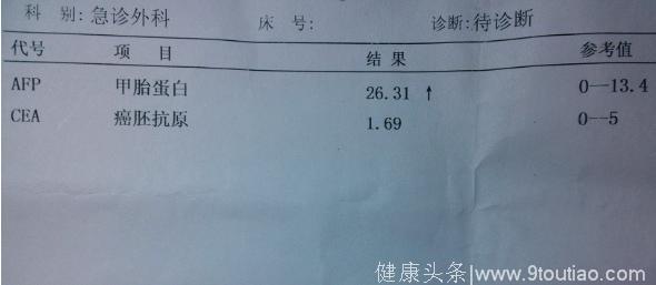 身体出现4个变化，当心肝炎变肝癌，1食疗方排净肝毒，阻挡肝癌