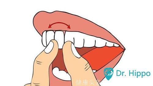 牙齿松动与年龄有直接关系吗？