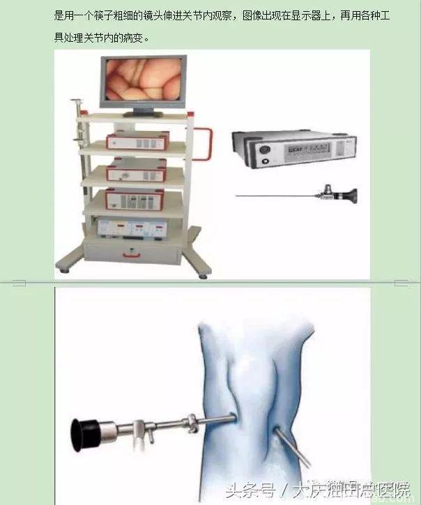 骨科副主任医师和你谈关节健康：膝关节疼痛不一定就是风湿……