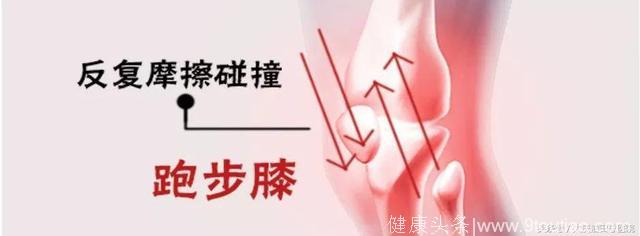 骨科副主任医师和你谈关节健康：膝关节疼痛不一定就是风湿……