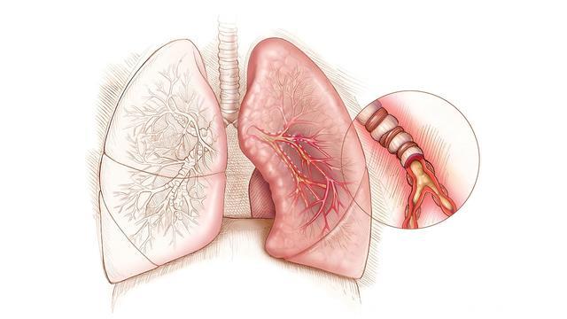 肺癌警告：出现这7个症状时，你正处于危险