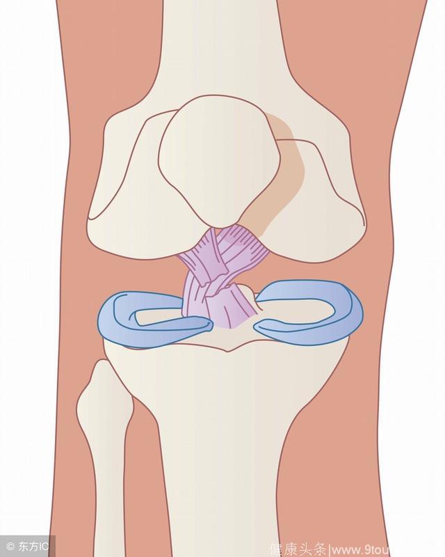 得了膝关节炎如何正确减痛和锻炼呢？这篇真相了！