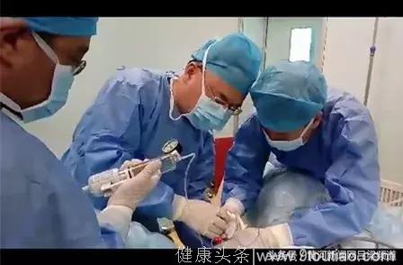 吕梁市人民医院顺利完成首例经尿道柱状水囊前列腺扩开术