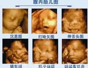 怀孕10月280天，胎宝宝都是怎样打发时间的？他们在子宫里嗨着呢