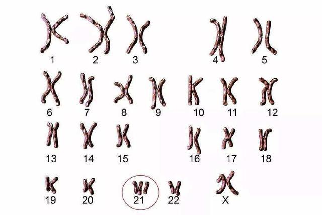 怀孕后，有多少孕妈被唐筛吓哭了？唐筛高风险的孕妈分享经历