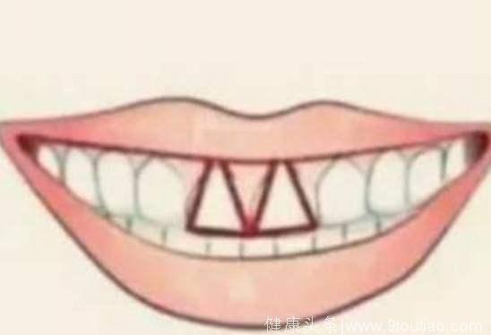 心理学：你的门牙是哪种？对号入座，测你是命中注定大富大贵吗！