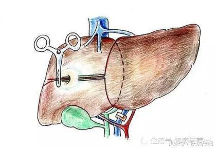 多吃这种食物，把肝“洗”干净！养肝排毒，肝脏越吃越健康！