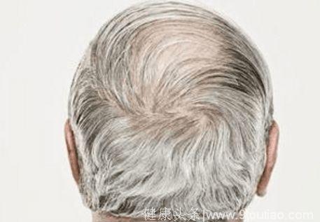 经常染发对身体健康有没有危害？养生专家告诉你正确的做法