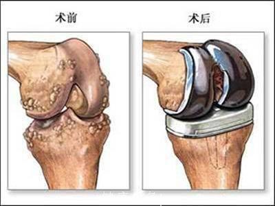 咱不说“冬病夏治”不说“三伏天”；咱来说说“关节炎”怎么办！