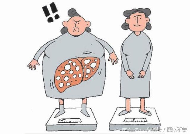 为什么消瘦的人也易患脂肪肝？预防脂肪肝营养均衡最重要