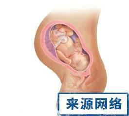 怀孕后期肾积水该怎么办？