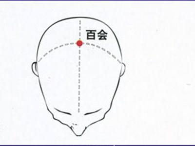 治疗健忘、老年痴呆的穴位，简单实用，您值得一看！