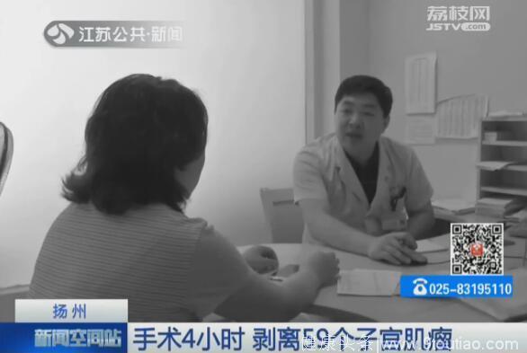 考虑清楚再点开：手术4小时 42岁女患者剥离59个子宫肌瘤