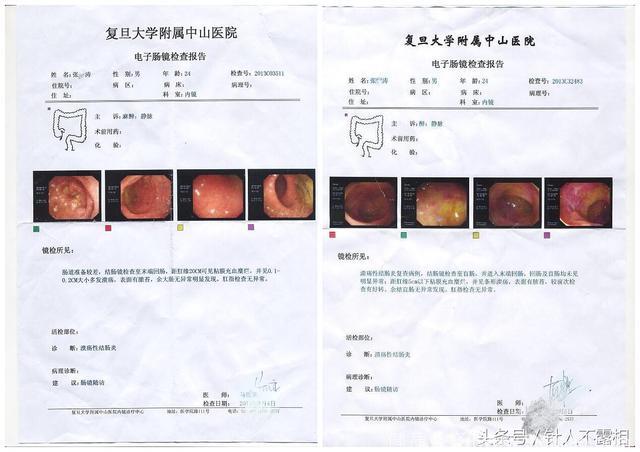 赶走腹泻，让你无“泻”可击，这2个穴位可以帮助你！