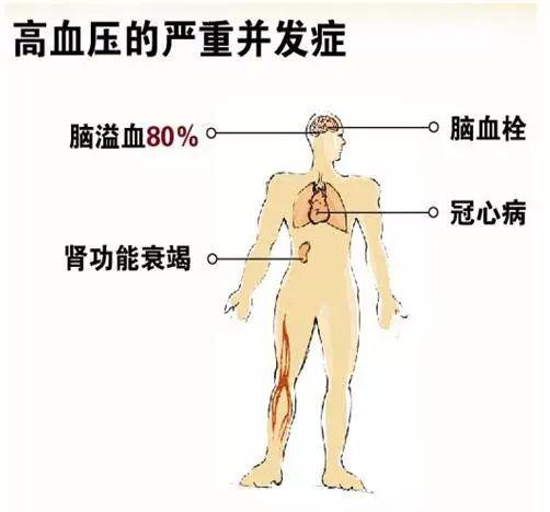 专家答疑︱高血压患者的自我管理