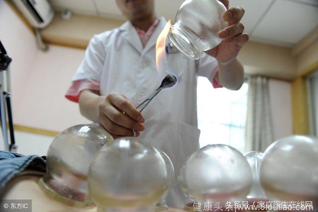 拔火罐是常见的中医疗法，了解这些利与弊，做出正确选择