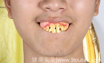 心理学：你的门牙是哪种类型？一眼看出你天生是什么命！