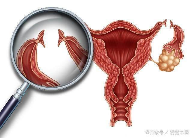 女人不想那么快怀孕？这4个方法能够帮到你，第3个最好操作！