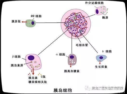 当糖尿病血糖高不好控制时，有可能同时得了这个病，查查吧