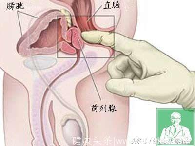 前列腺电切术后面面观那些揪心的注意事项？