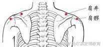 肩周炎是什么引起的怎么治疗