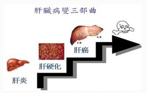 从脂肪肝到肝癌，距离多远？常做这4件事最伤肝！