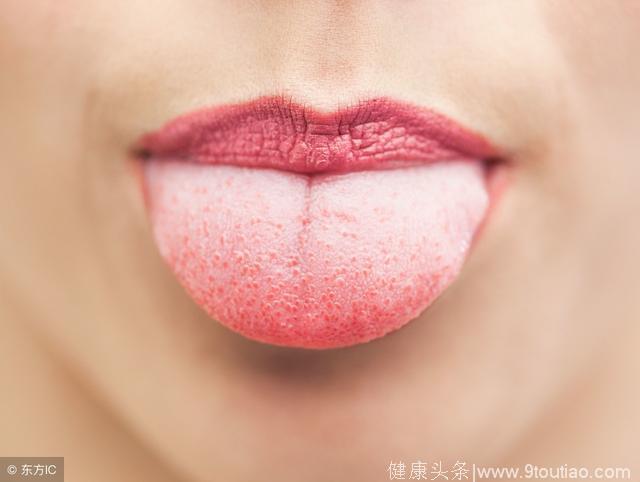 乙肝病毒携带者可出现舌苔发白