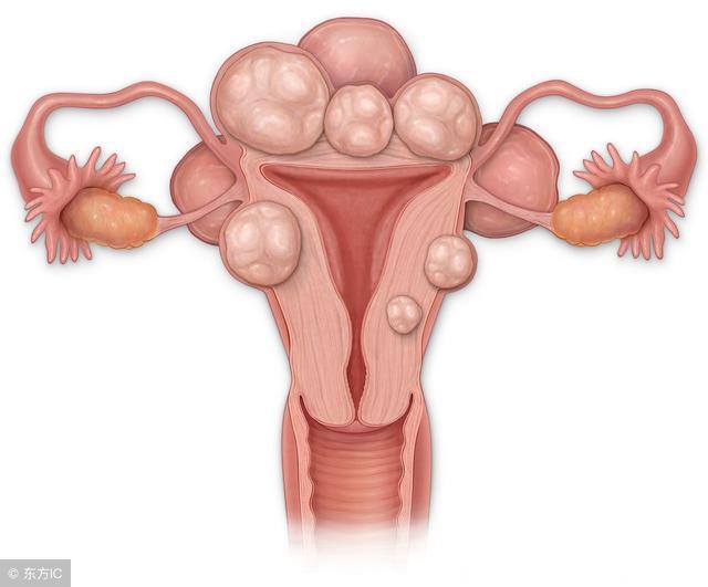 经期出现这几个表现，预示子宫肌瘤找上身，教你5招巧预防！