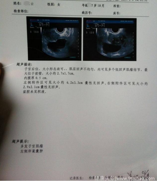 三年了！多发子宫肌瘤！居然还怀上双胞胎？！老天呐！