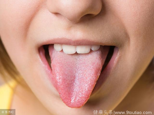 糖尿病病人好帮手，看舌头辨别体质选择中药辅助治疗糖尿病