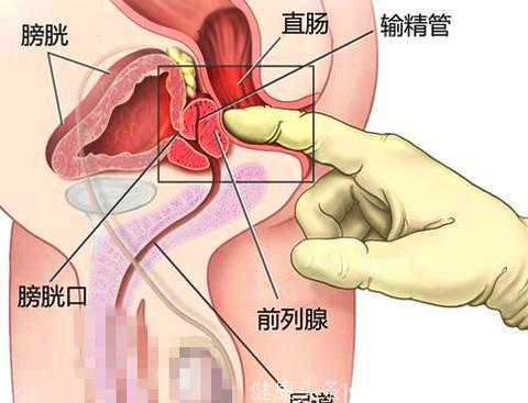 男人前列腺不好，自己动手按摩1个位置，从此痛快淋漓不怕腺痛