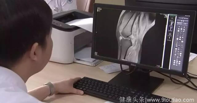 头皮发麻！29岁女子膝关节布满“米粒”，惠州年轻人要特别注意！