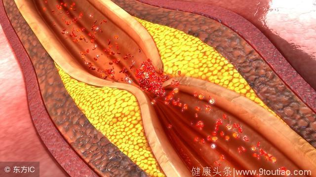 怎样辨别是否得了冠心病，冠心病的控制方法