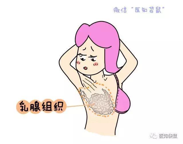 这些乳腺增生的症状，很容易被当成来大姨妈的信号，看看你有吗？