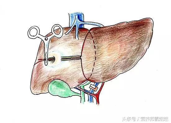 肝不好，身体有5大“改变”，做好“4个字”，还你一个好肝！