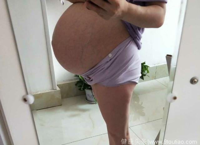 顺转剖，生下7.4斤男宝一枚，附上孕期反应