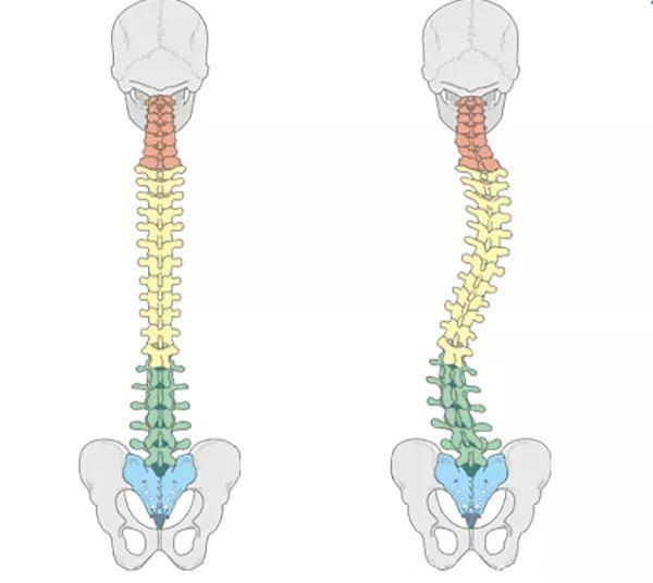8个瑜伽拉伸体式，改善脊柱侧弯