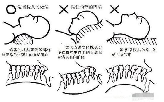 颈椎病疼起来真要命，教你1招轻松远离它，不花一分冤枉钱！